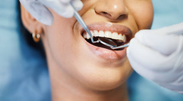 Best After-Hours Dental Trauma Care in Glasgow, VA